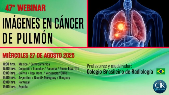 47° Webinar
