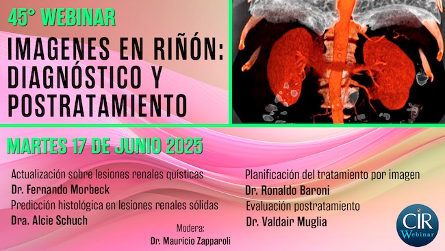 45° Webinar